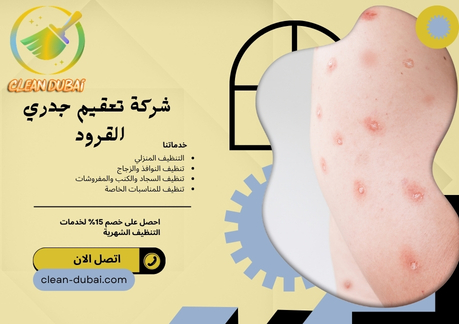 شركة تعقيم جدري القرود 